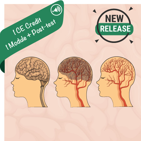 Basics of CT Brain Perfusion