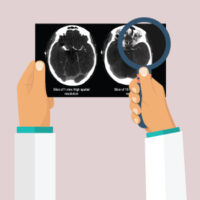 CT Image Quality and Informatics