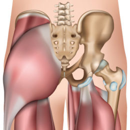 Echographie Musculo-Squelettique de la Hanche et des fesses