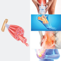 Echographie Musculo-Squelettique Membres Inférieurs