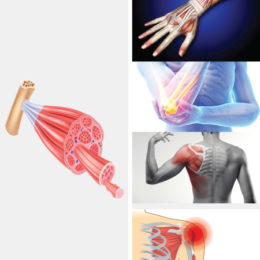 Echographie Musculo-Squelettique Membres Supérieurs