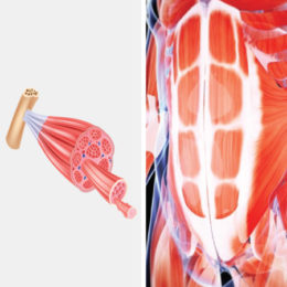 Echographie Musculo-Squelettique Parois de Tronc et Sémiologie